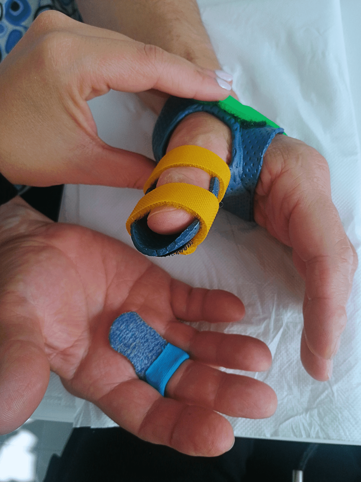 Fisioterapia specialistica polso e mano