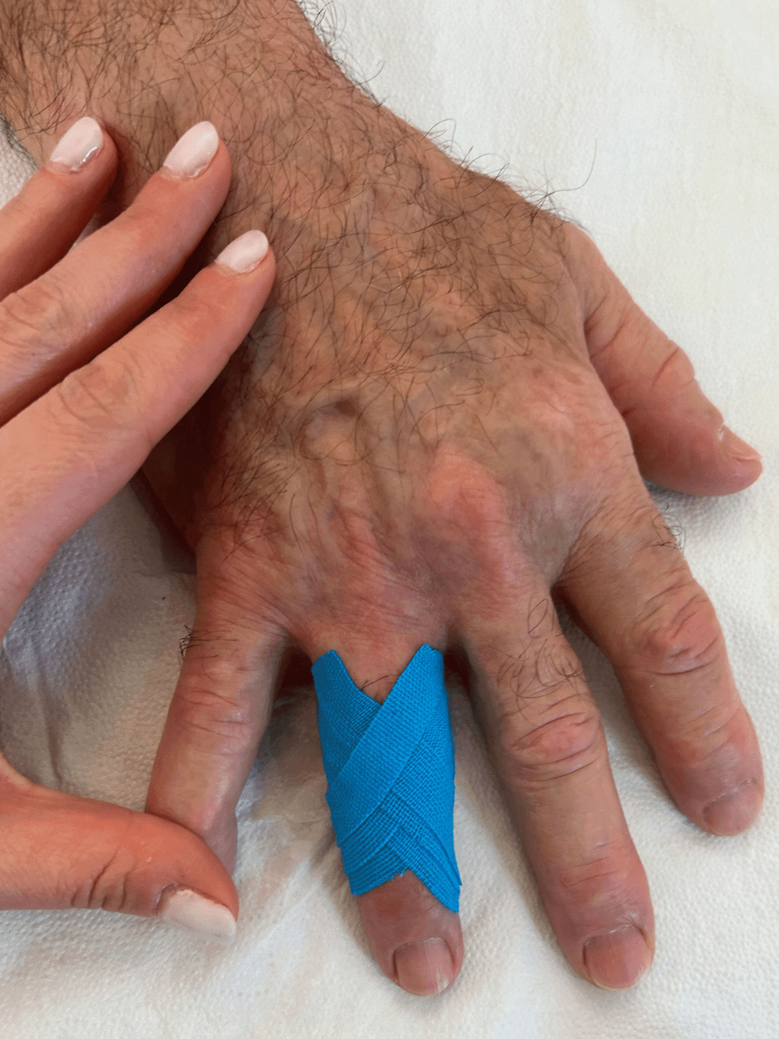 Fisioterapia specialistica polso e mano