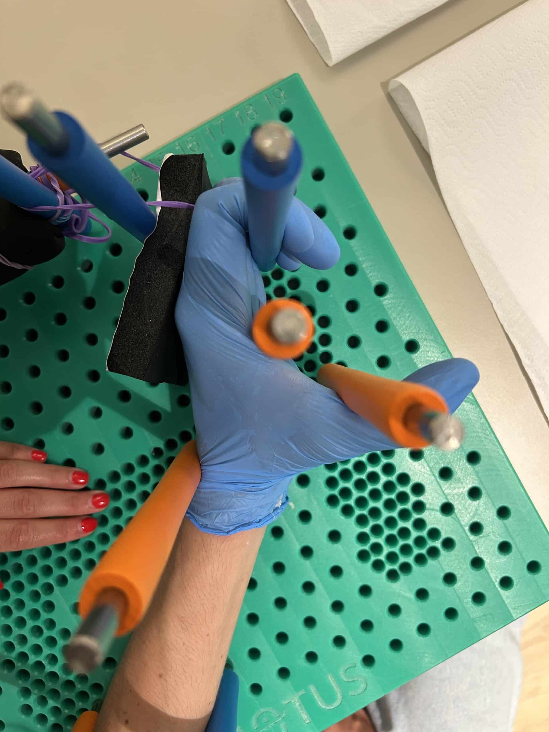 Fisioterapia specialistica polso e mano