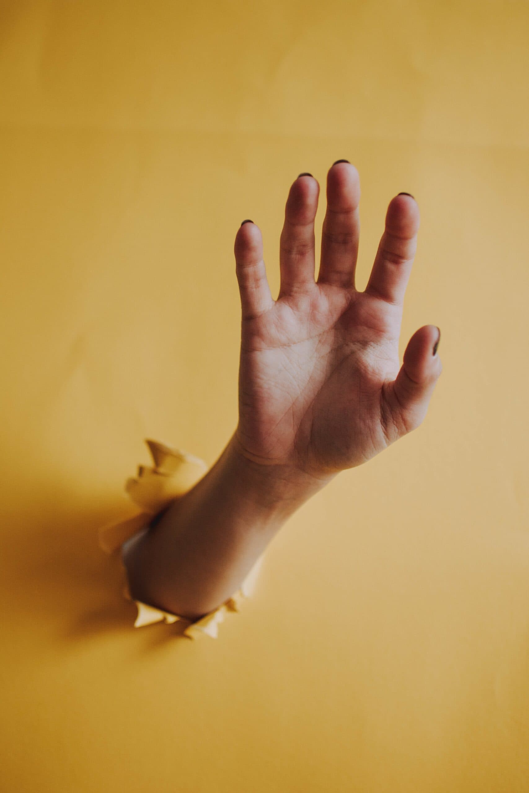 Quali sono i tempi da rispettare a seguito di una frattura di arto superiore? Polso, mano, gomito o spalla?