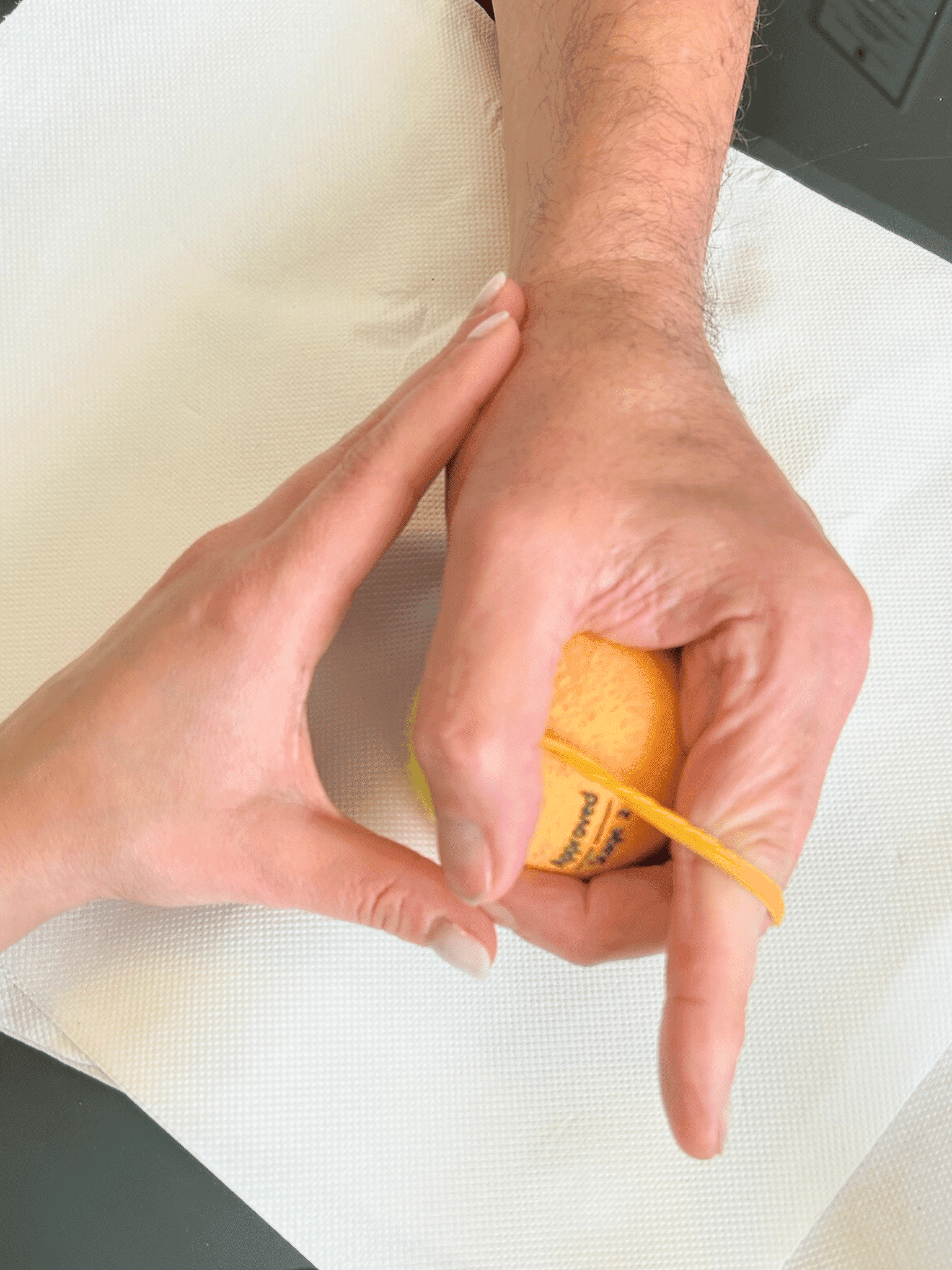 Fisioterapia specialistica di polso e mano